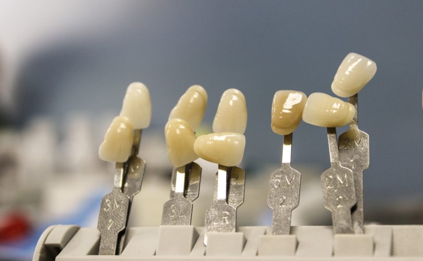 Piękne urodziwe zęby także świetny przepiękny uśmiech to powód do zadowolenia.